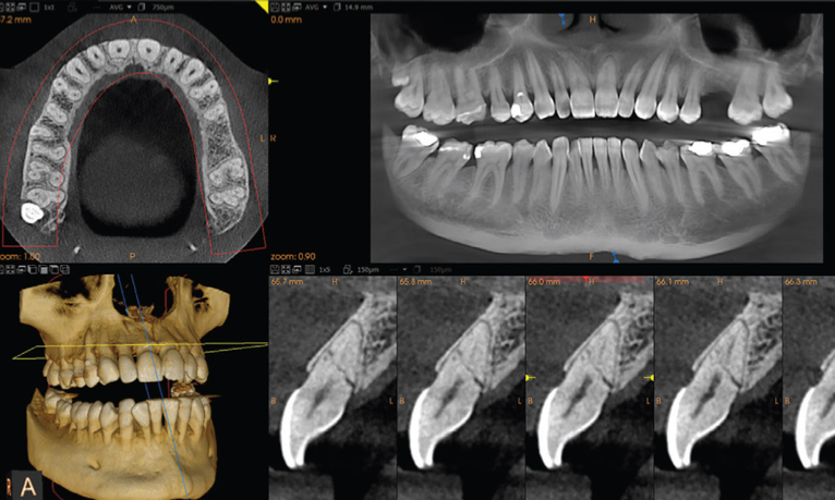 3d-scanner.png